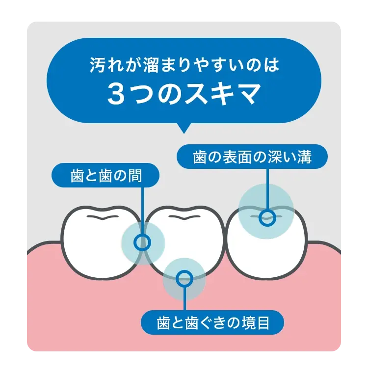 kiseki